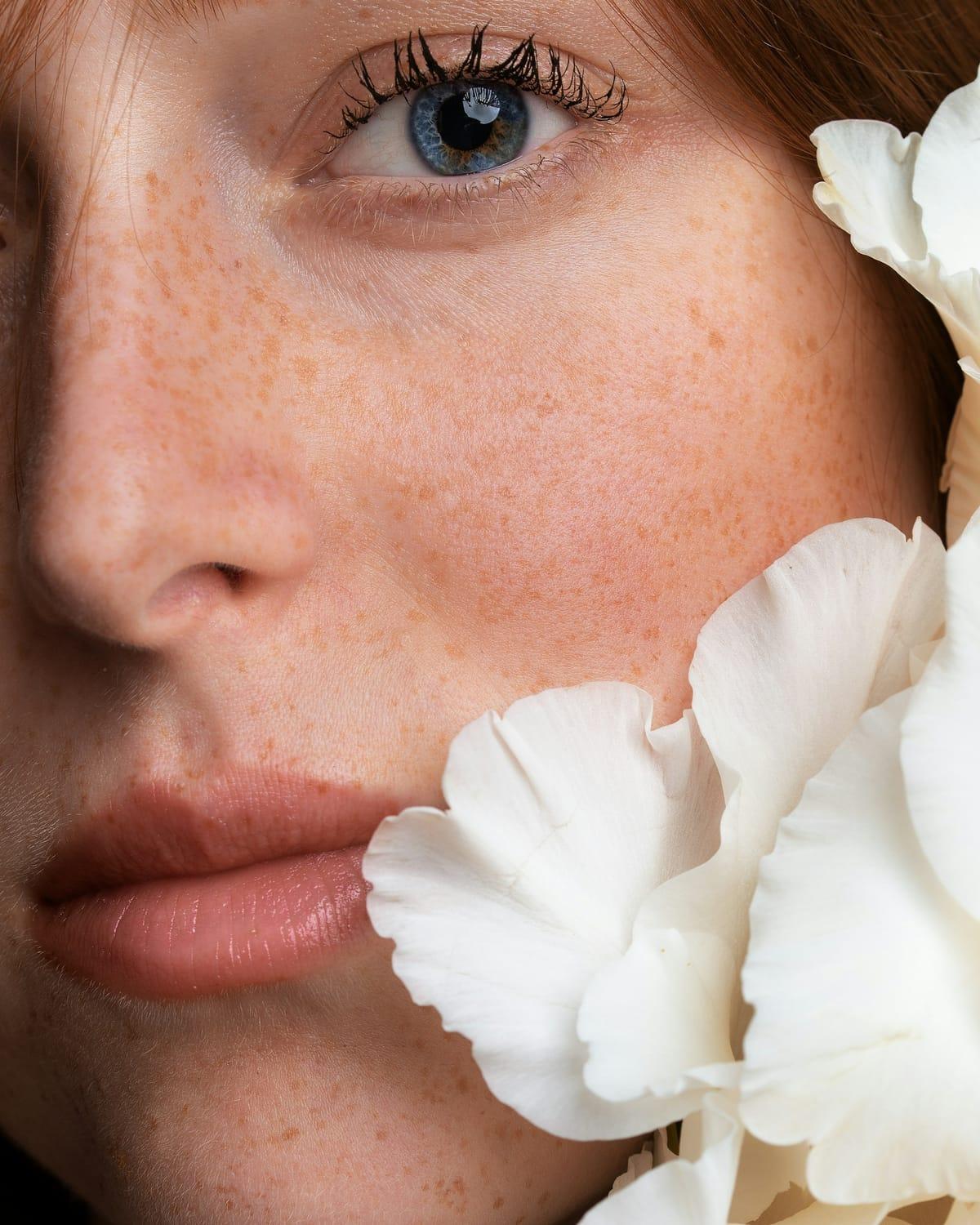 Close-up of a freckled woman's eye and cheek beside soft white flowers