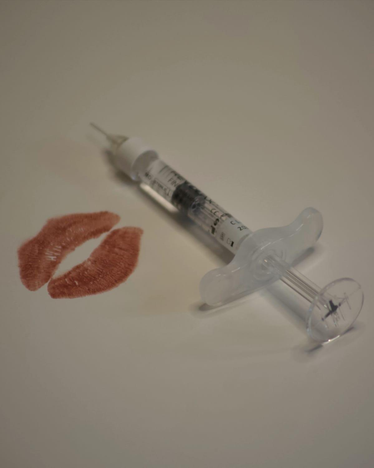 A lipstick kiss print beside a filler syringe on a pale surface
